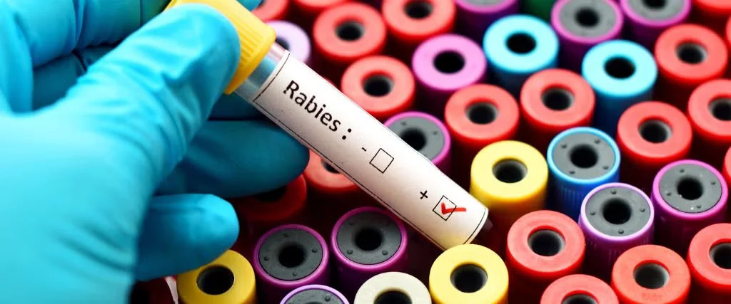Rabies test tube held above colorful lab sample containers
